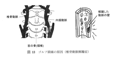 図13