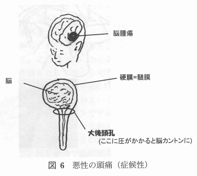 図6