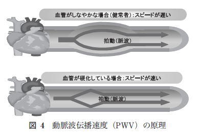 動脈伝播速度の原理